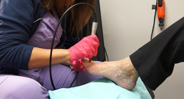 A podiatry specialist treats dermatitis.
